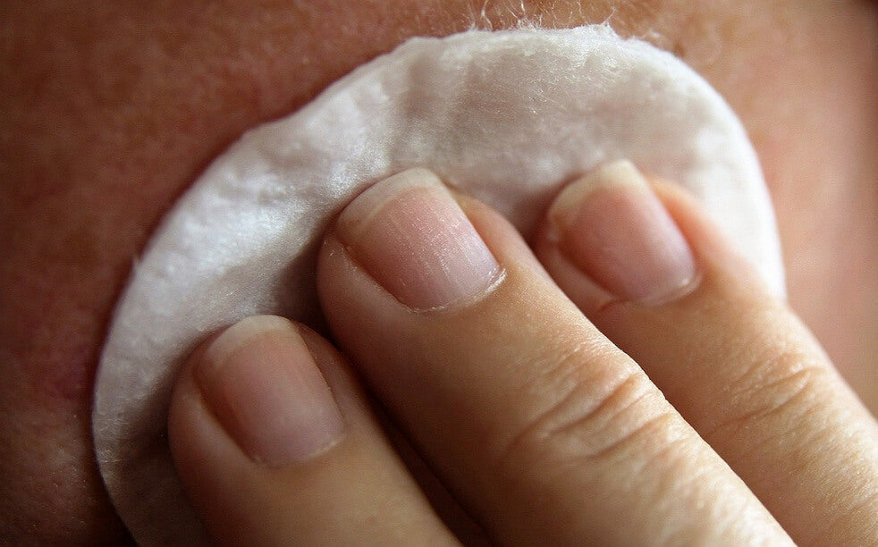 Dile adiós a las imperfecciones con tu propio gel anti acné